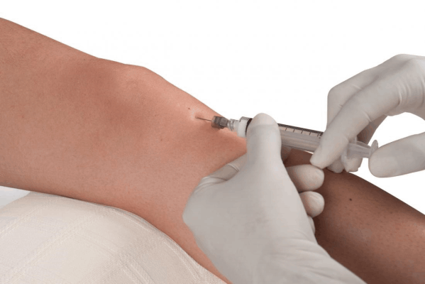prolotherapy treatment
